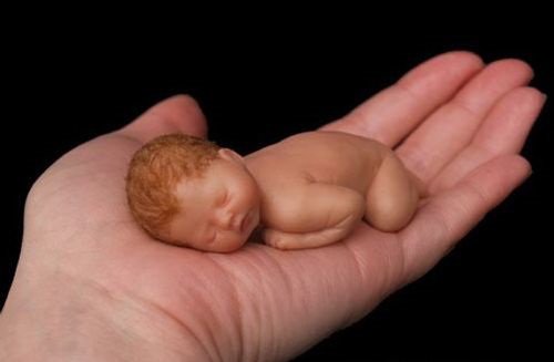 Phá thai - Hình ảnh minh họa